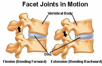 Chiropractic Richmond VA Facet Syndrome