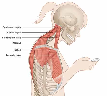 Chiropractic Richmond VA Forward Head Posture